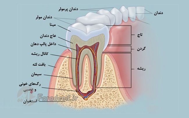 دندان درد چیست؟